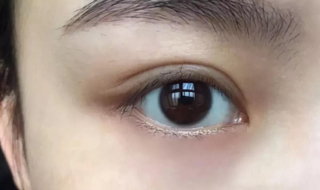 雅诗兰黛日本产的眼霜,用了雅诗兰黛皱纹更明显了