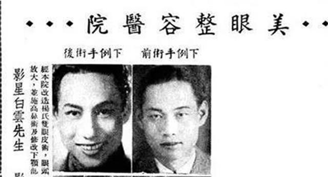 上海整容名媛,上海整容医院排前十名割眼袋