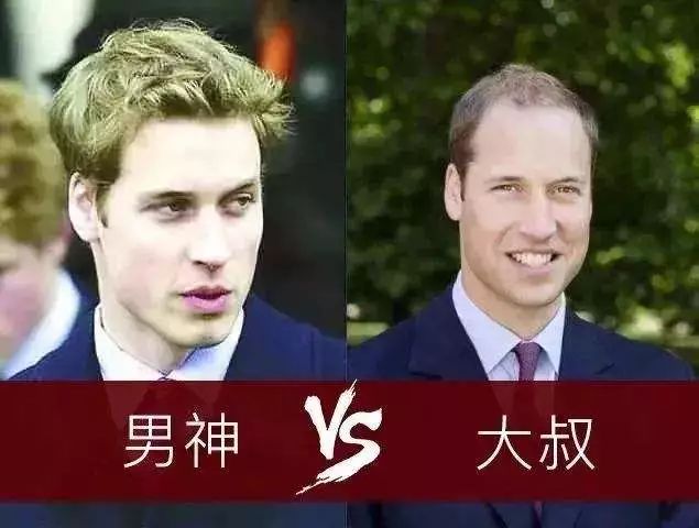 发量减少好不好,发量减小