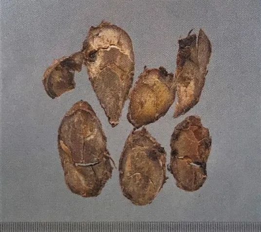 草药莪术的功效与作用,醋莪术行气破血什么意思