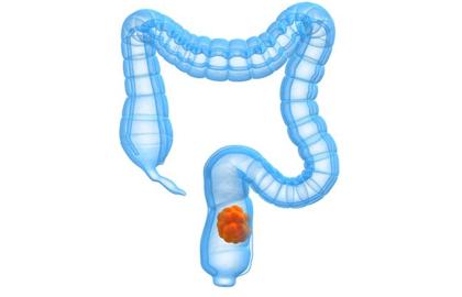 宝宝长期便秘十大危害,长期便秘十大危害