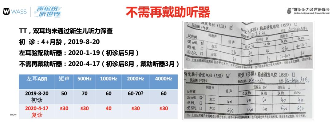 WASS峰会｜针对病因有效治疗，可改善部分儿童的听力损失