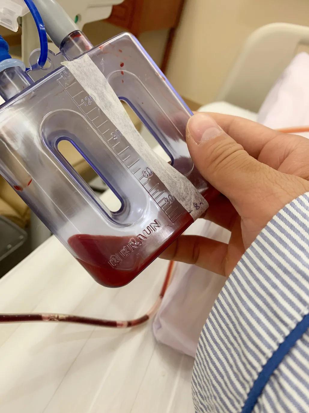 一张图看懂跟腱断裂,跟腱断裂日常