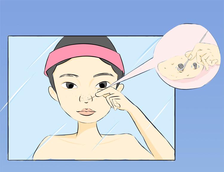 挤黑头把鼻子挤厚大了如何拯救,怎样祛黑头摆脱草莓鼻