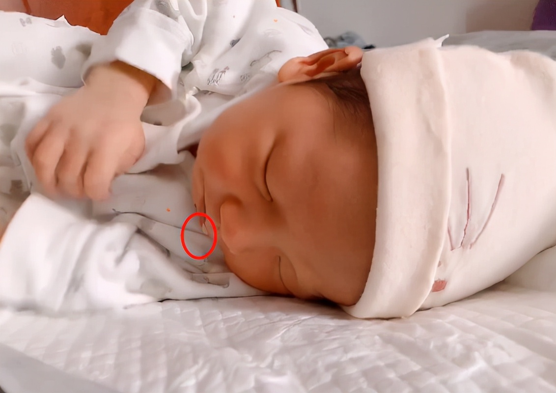 小宝宝吐奶的正确处理方式,宝宝爱吐奶怎么忌口