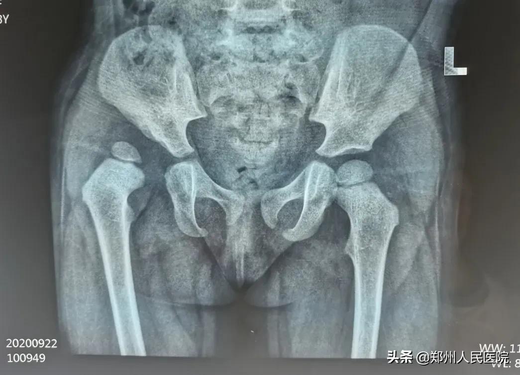 走路像鸭子一样摇摆,走路像鸭子的样子