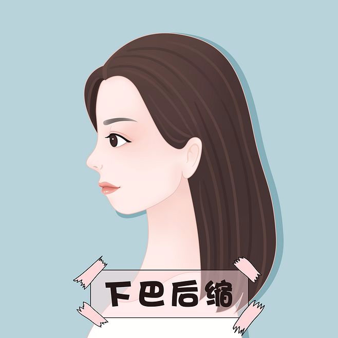 下巴上翘显得脸方,下巴往前翘而且饱满