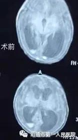 昭通第一人民医院早产儿科,昭通市第一人民医院儿外科