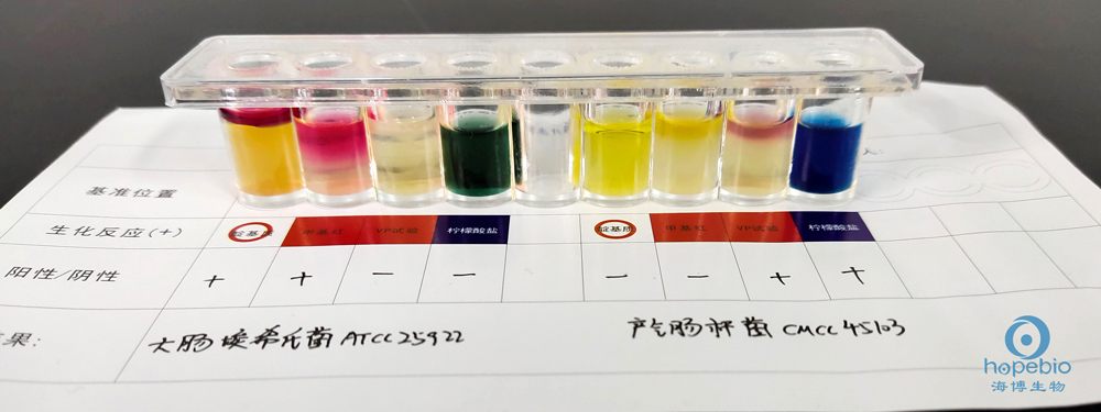 大肠埃希菌菌落计数10.5,大肠埃希氏菌计数3+严重吗