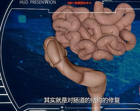 因肠病导致的便秘好治疗吗,如何能治疗结肠便秘