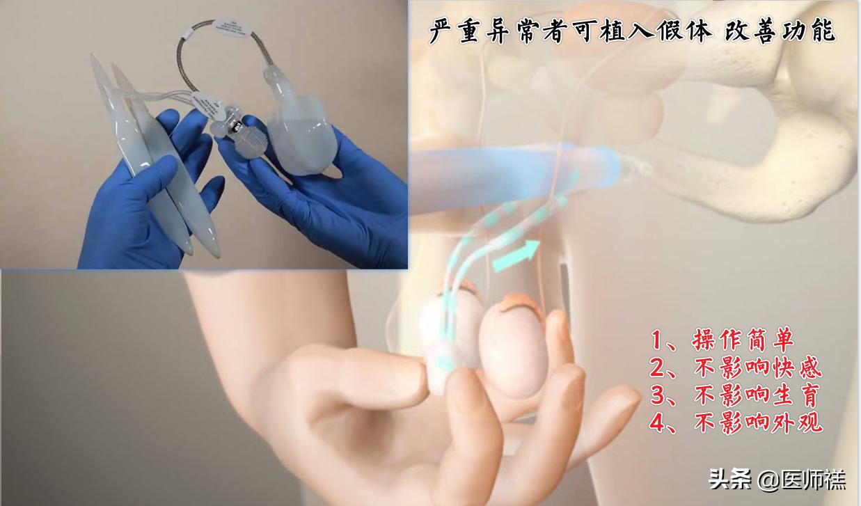 蓝色小药丸吃了多久起效,吃了蓝色药丸就有效吗