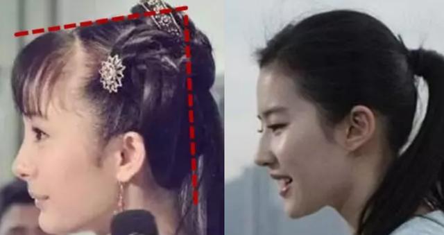 秃头大夫教你让头发浓密且多,秃头少女该如何挽救头发