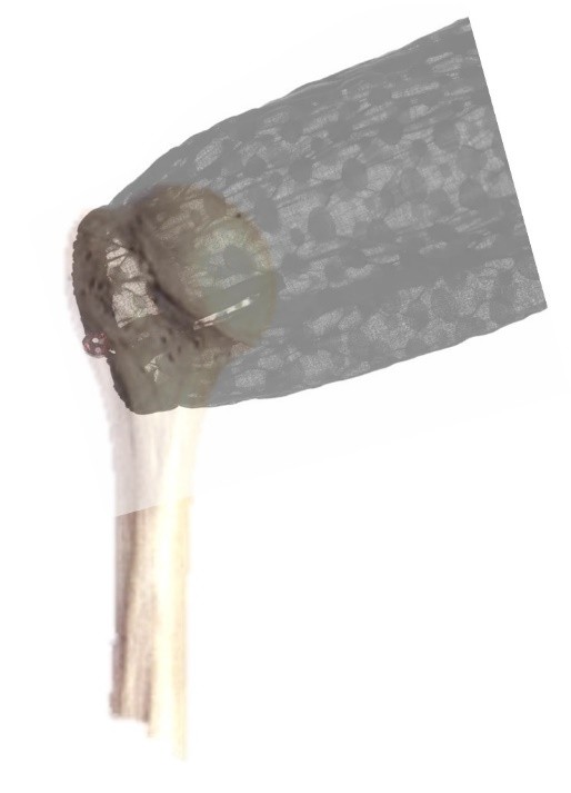 肩袖损伤和肩周炎的鉴别方法口诀,如何区别肩袖损伤跟肩周炎