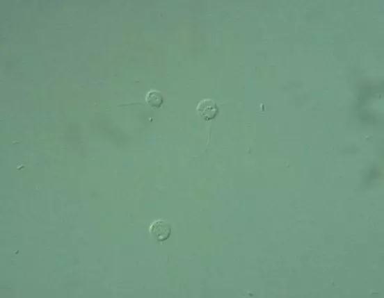 收藏!24种污水处理微生物菌相及指导意义,环保人必看(多图)