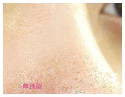 毛孔缩小最好的方法,毛孔是否能缩小