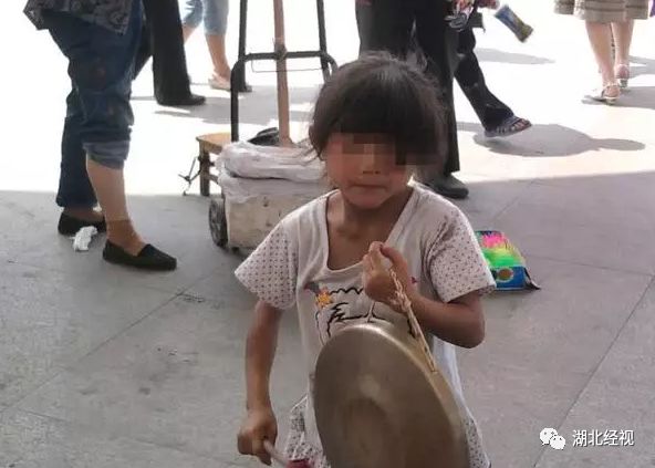 眼球被挖走了还能恢复吗,眼球被挖了还会活着吗