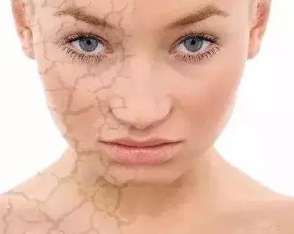 厦门鱼友爆料：“男友跟我承认他是鱼鳞病了！我觉得好恶心啊！”