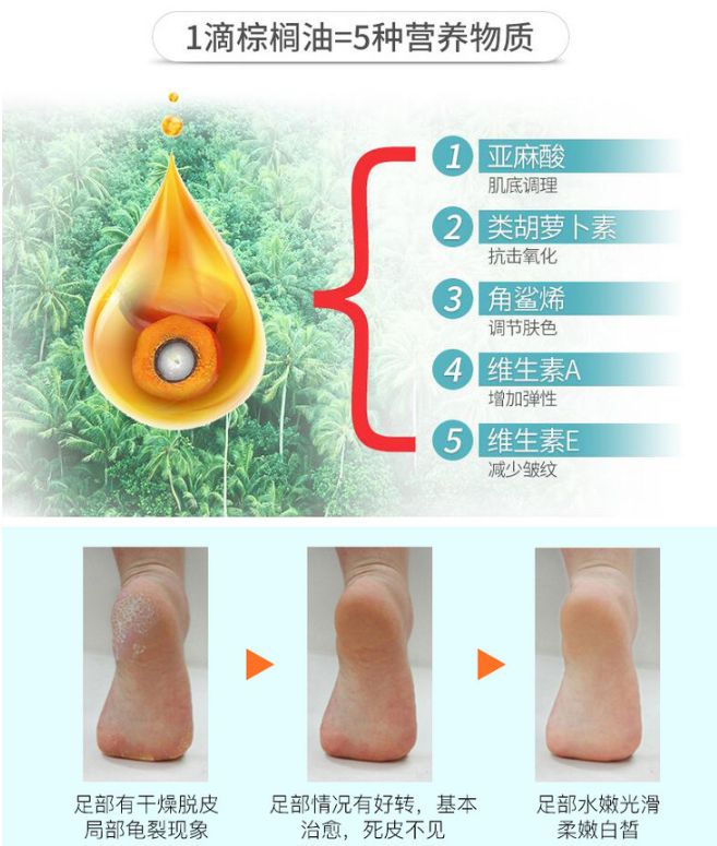 脚气特别痒用什么泡脚效果好,脚气脚臭脚痒的克星用什么