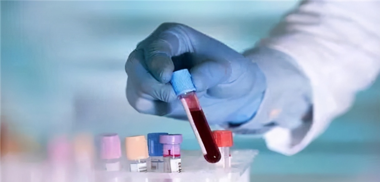 熊猫血精子一般生不了二胎,老婆是熊猫血可以要二胎吗