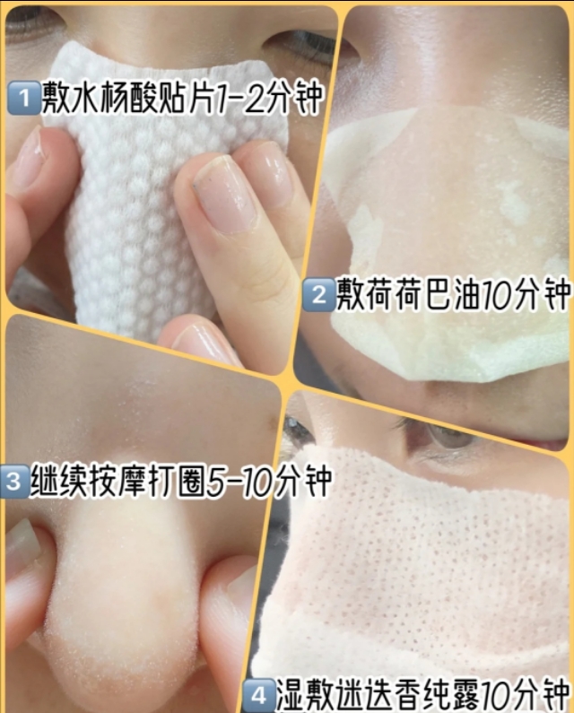 去黑头不伤皮肤的最好方法,去黑头不伤皮肤的最有效方法