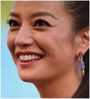 去皱纹轻松拥有好皮肤,皮肤皱纹多吃什么保养