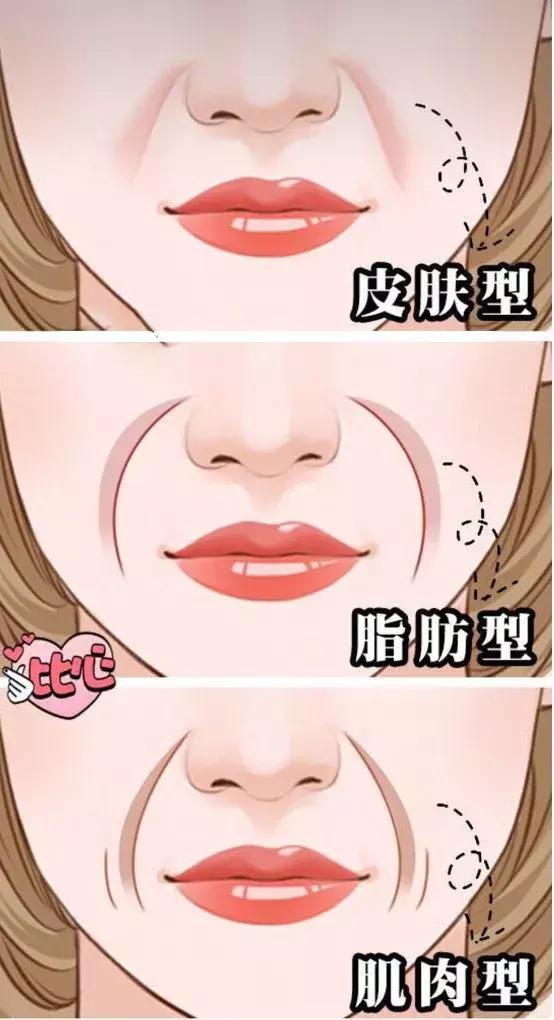 怎样改善法令纹深脸部下垂,怎样改善法令纹木偶纹