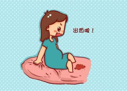 孕早期出血先别慌，可能没您想的那么糟糕，听听过来人怎么说！