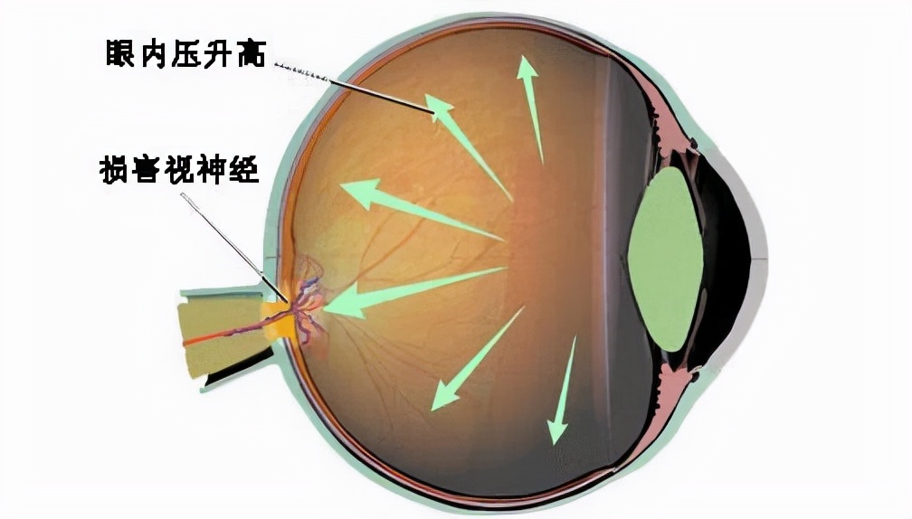 人的眼球掉下来怎么办,外伤引起的眼球充血多久能好