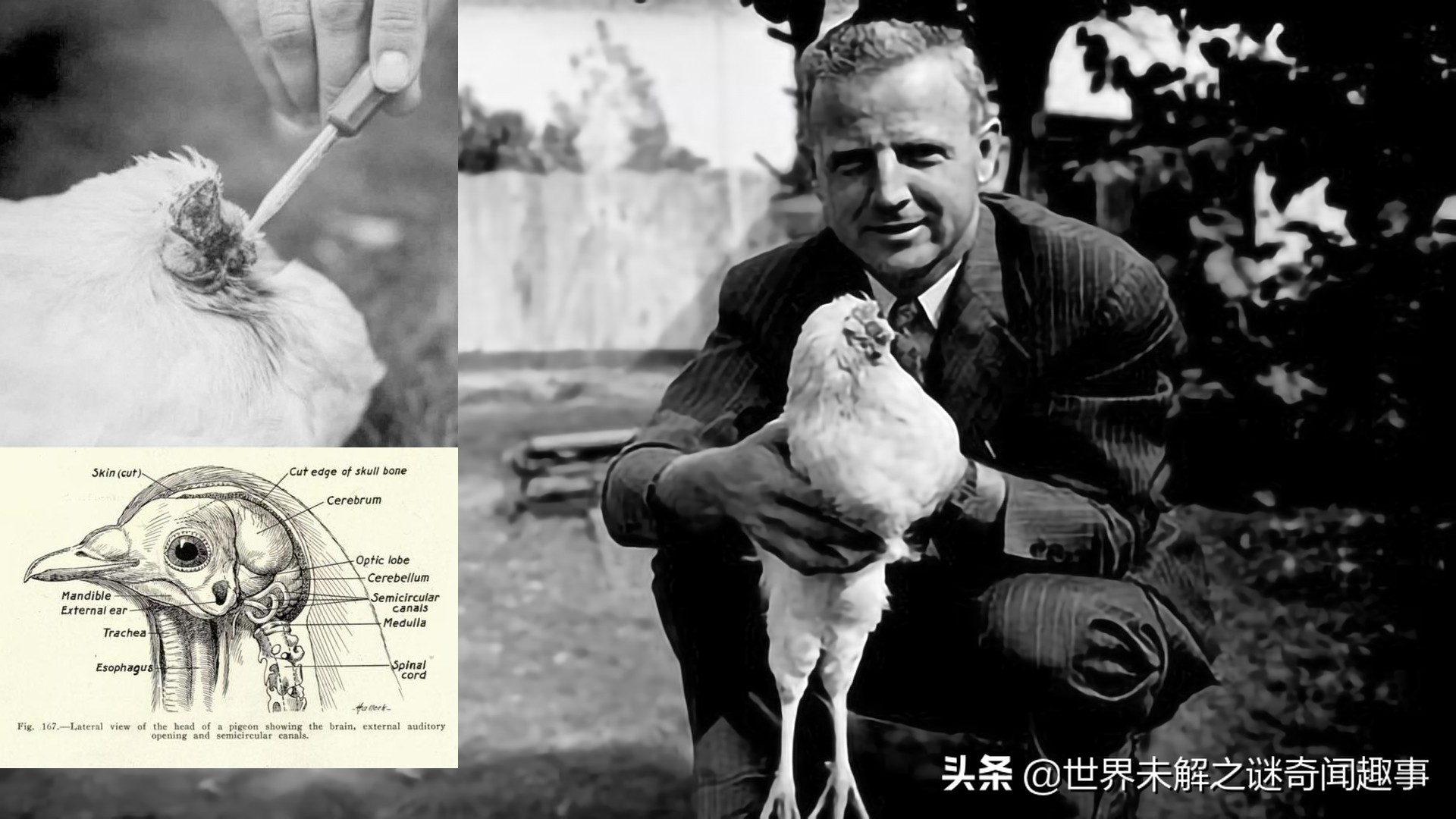 没有脑子还能活的动物,没有脑子的人存活的案例