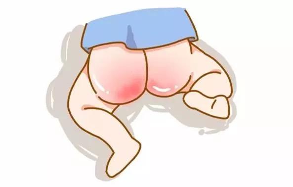 宝宝为什么一直红屁屁长疹子,为什么宝宝都会红屁股