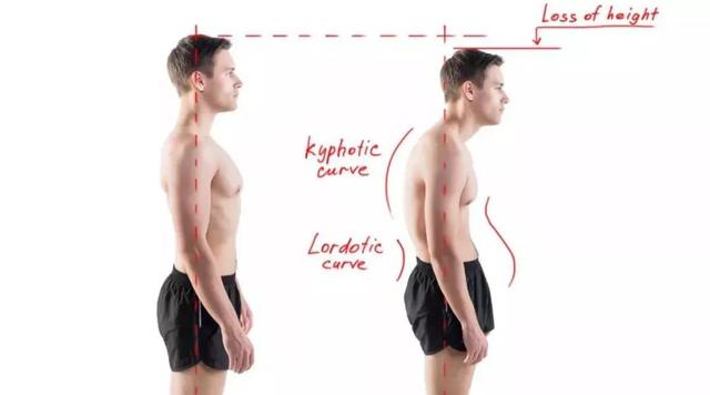 会越变越丑的姿势怎么纠正,让人变丑的最快方式