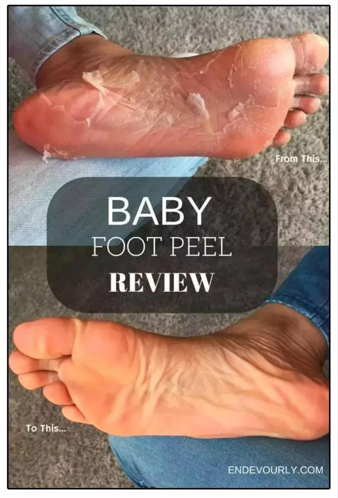 足部护理滋润皮肤让足部保持舒适,秋冬季足部护理