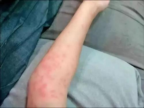 端午节怎么避毒,端午节需要注意的事项