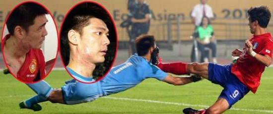 广州恒大悉尼曾诚受伤,恒大送走功勋老将曾诚