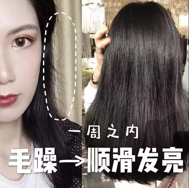 头发毛躁并且脱发推荐洗发水,用什么洗发水改善头皮脱发