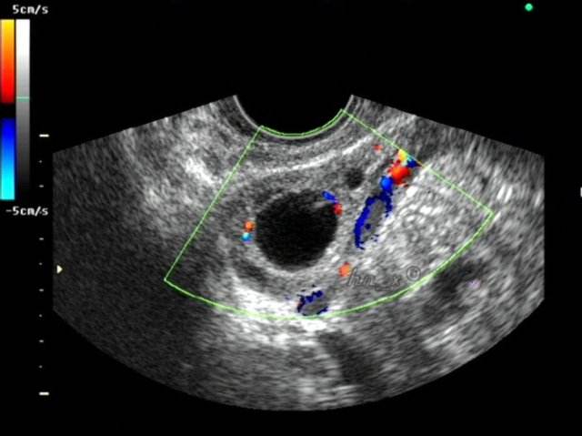 备孕时注意什么有助于快速怀孕,备孕的最佳时机及注意事项