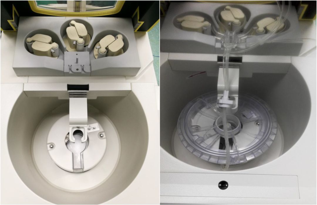 马康:术中自体血液回收