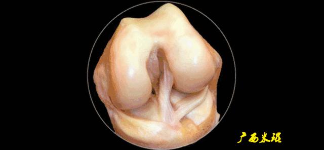 前交叉韧带扭伤最快自愈方法,前交叉韧带损伤膝关节会疼吗