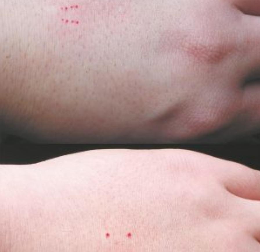 为何蛇类不怕雄黄粉了？蛇最怕什么？这就来解释原因