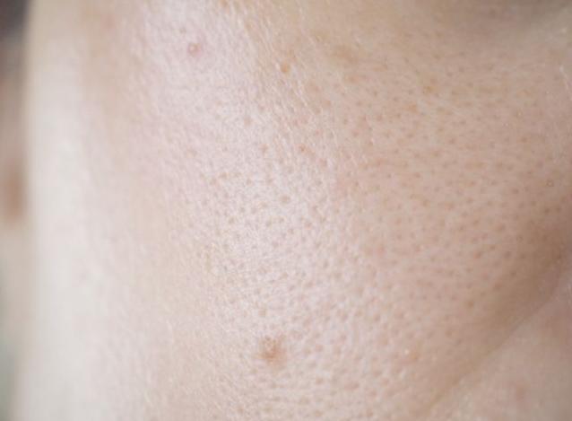 毛孔粗大推荐产品,最好用的收缩毛孔的产品