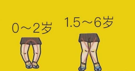 小孩是o型腿图片,孩子x型腿很严重应该怎么解决