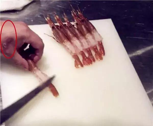 网红日料店卫生堪忧厨师,厨师手上有疮