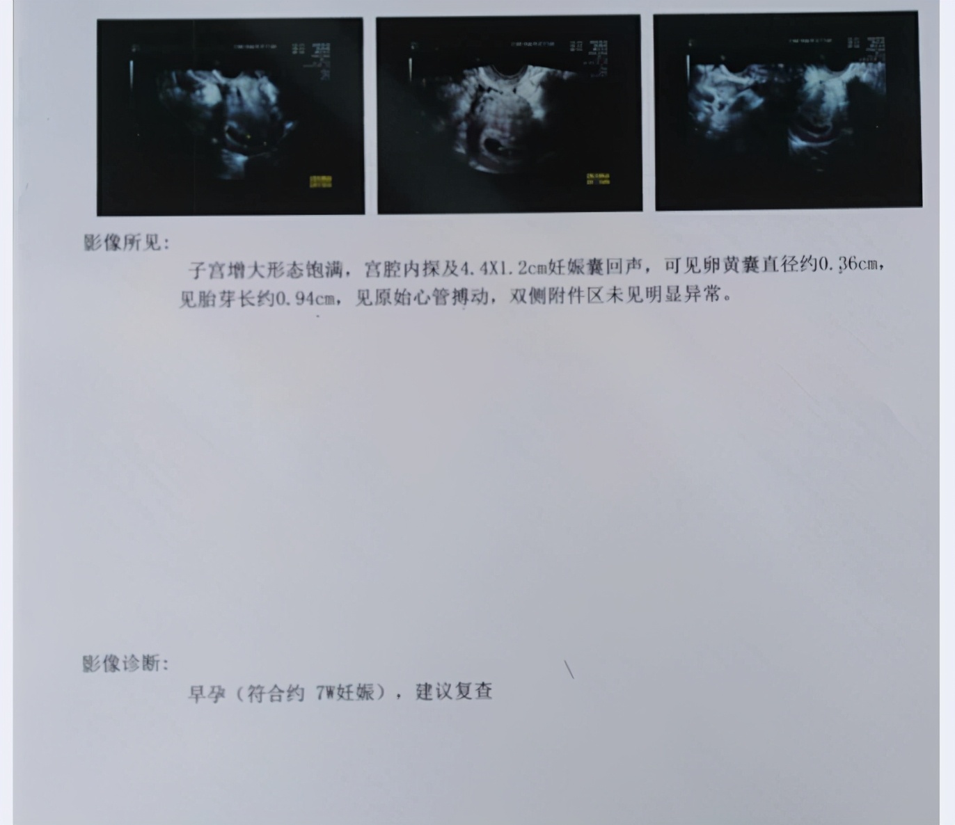 婆婆带媳妇去医院不孕不育,婆婆带着怀孕儿媳去医院