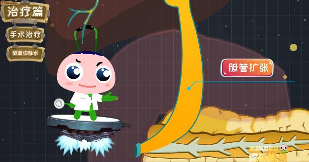 胆囊炎胆结石怎么治疗最有效,胆囊炎胆结石疼痛如何快速缓解