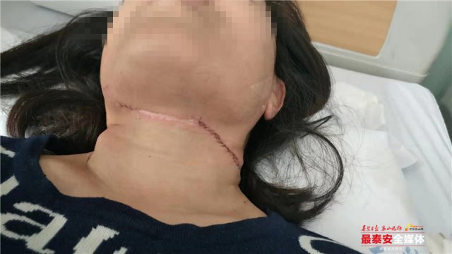 事发*安泰**！女子骑电动被风筝线割伤，割喉伤处缝补30多针
