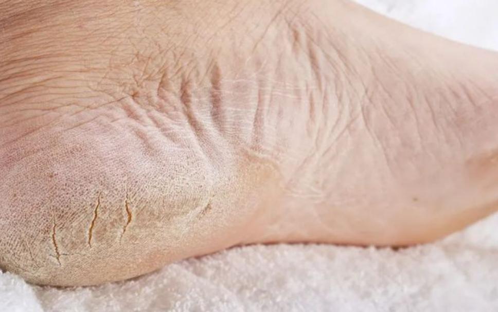 为什么日本人一年四季都穿袜子,日本人睡觉穿什么样的袜子