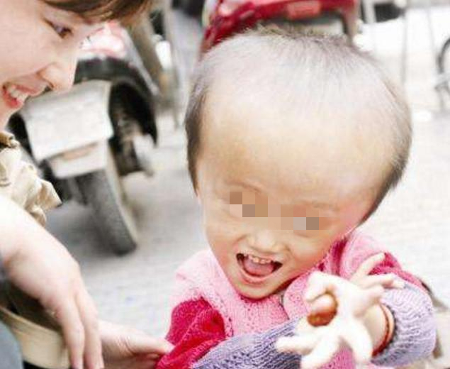 1998年和1999年三鹿奶粉有问题吗,十年前吃三鹿奶粉还需要复查吗