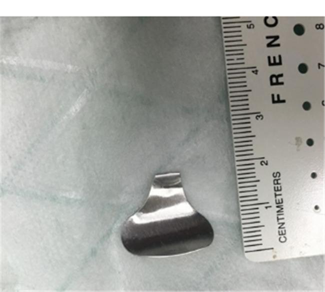 宝宝误吞异物怎样才能确定没事,宝宝误吞异物多大危险