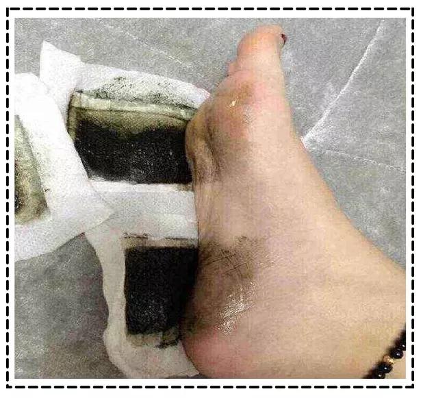 十大美容单品排行榜,这几年流行的养生美容爆品