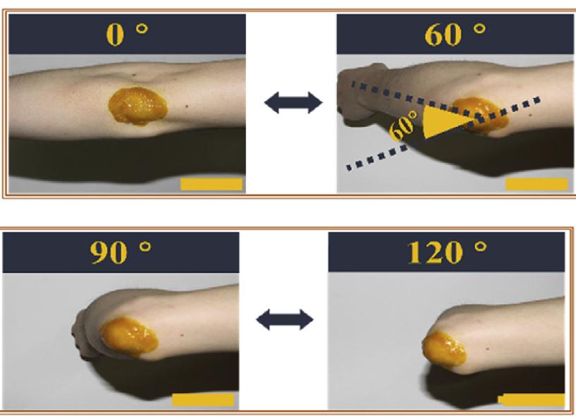 美食→生物材料|小龙虾→伤口敷料